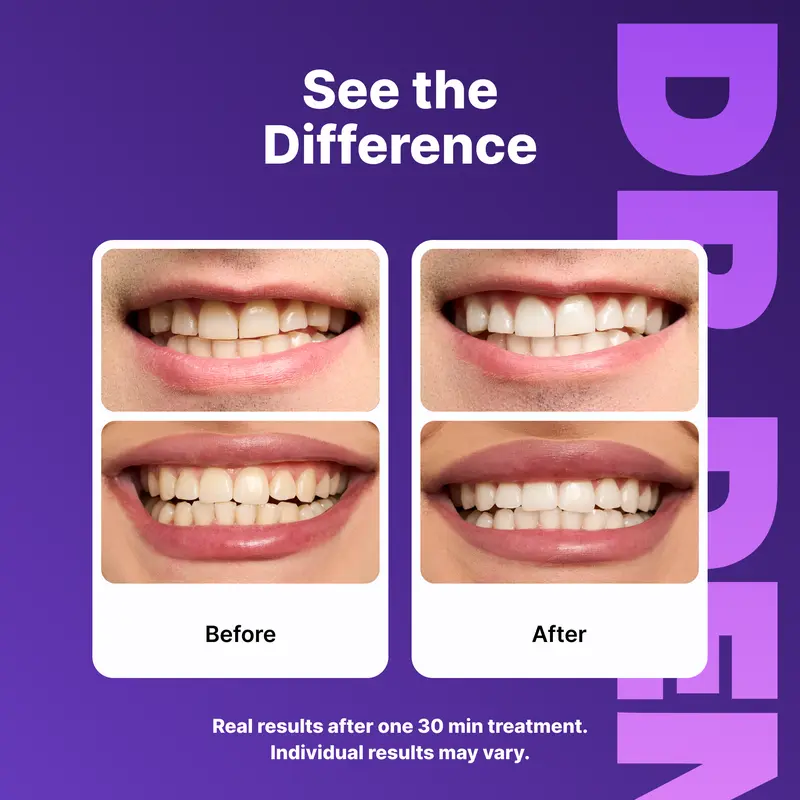 7 Purple Strips = 21 Whiter Smiles – No Pain, No Peroxide, Just Results